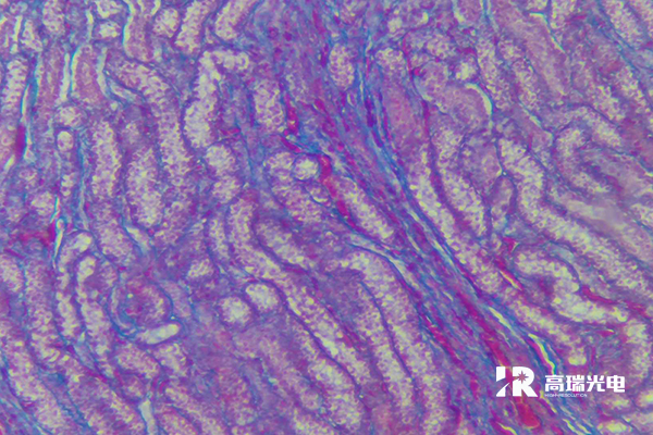 Key Parameters of Optical Microscopes：Resolution