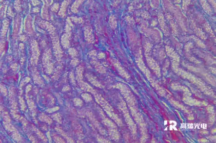 Key Parameters of Optical Microscopes：Resolution